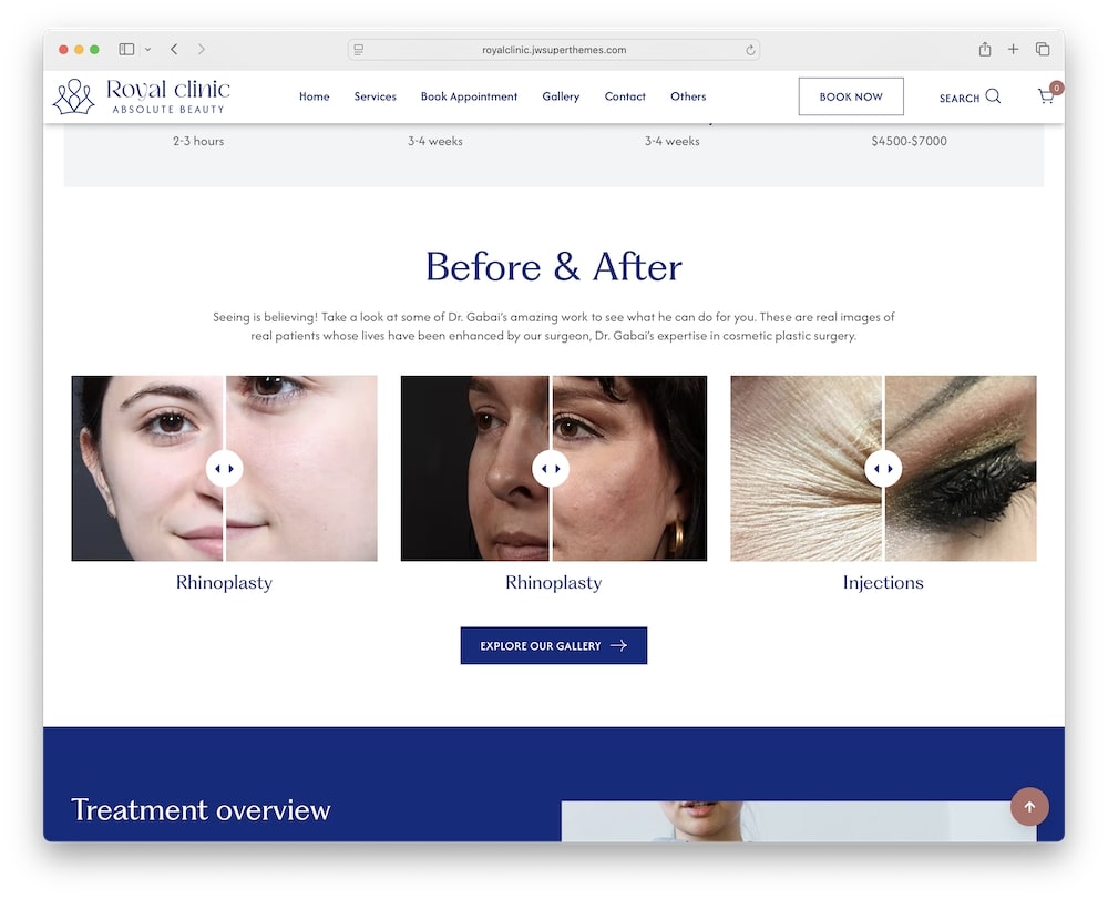 royal clinic wordpress theme before and after galleries